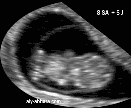 Motricité embryonnaire à 9 SA  plus ou moins 2 jours