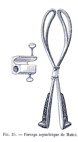 Forceps asym&eacute;trique de Mattei