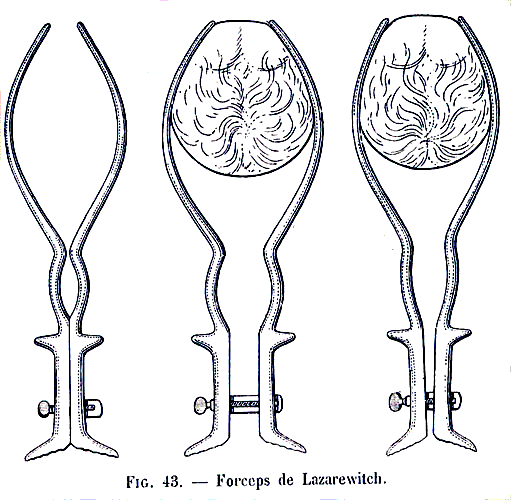 Forceps de Lazarewitch