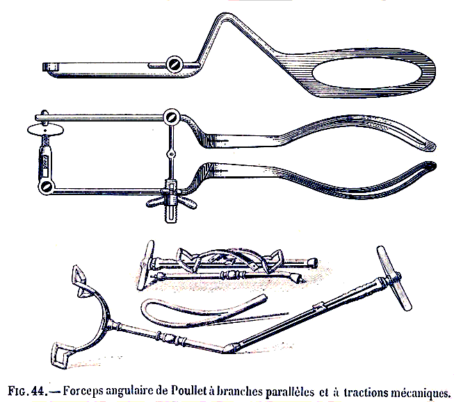 Forceps de Poullet &agrave; branche parall&egrave;les et traction m&eacute;canique