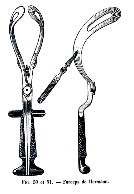 Forceps de Hermann