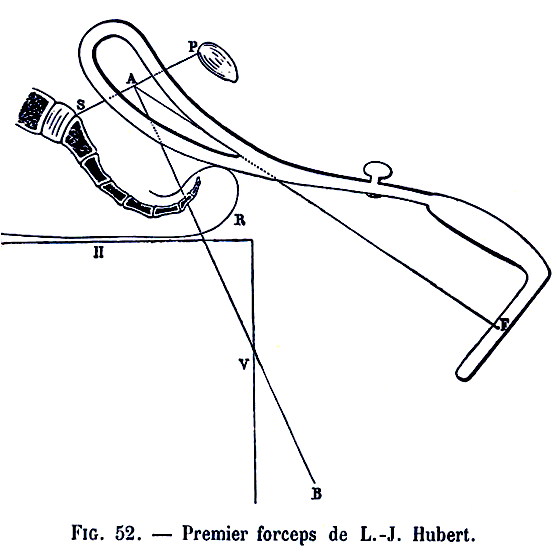 Forceps de Hubert (les tractions)