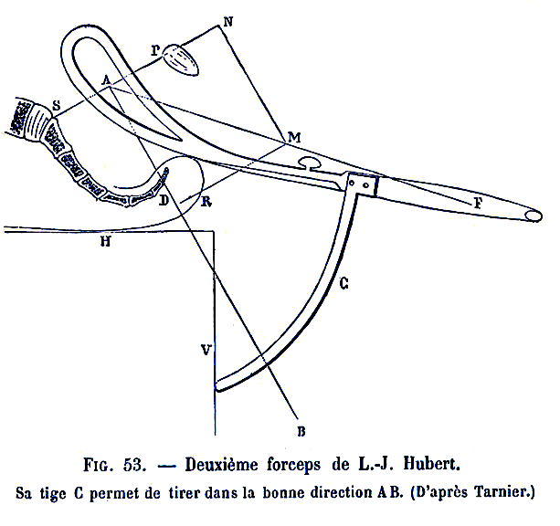 Deuxi&egrave;me forceps de Hubert