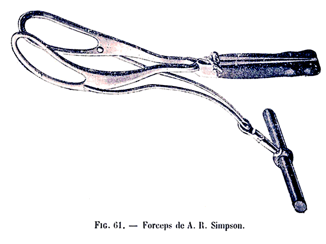 Forceps de A.R. Simpson