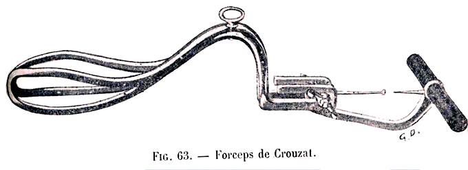 Forceps de Crouzat