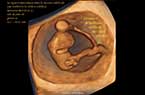 Embryon de 8 SA et 3 jours 