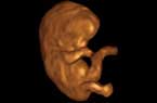 Embryon de 9 SA et 4 jours - Rotation axe Y