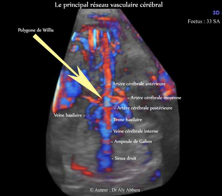 cerveau_polygone de Willis