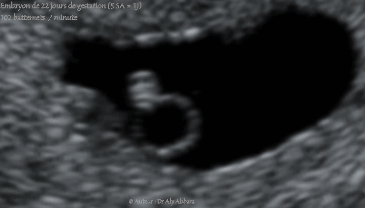 Premiers battements cardiaques chez l'embryon, à 22 jours de gestation - أول دقات القلب عند مضغة بعمر 22 يوماً