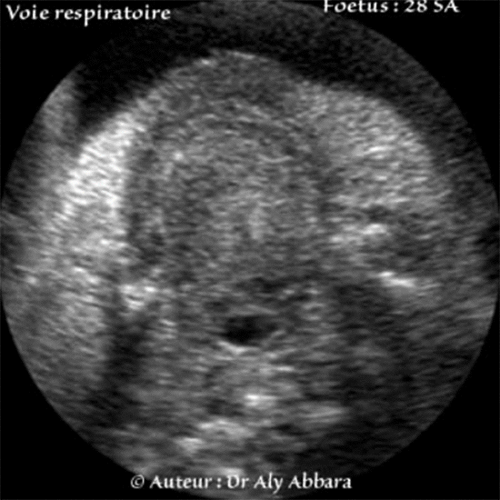 Pharynx - Foetus de 28 SA