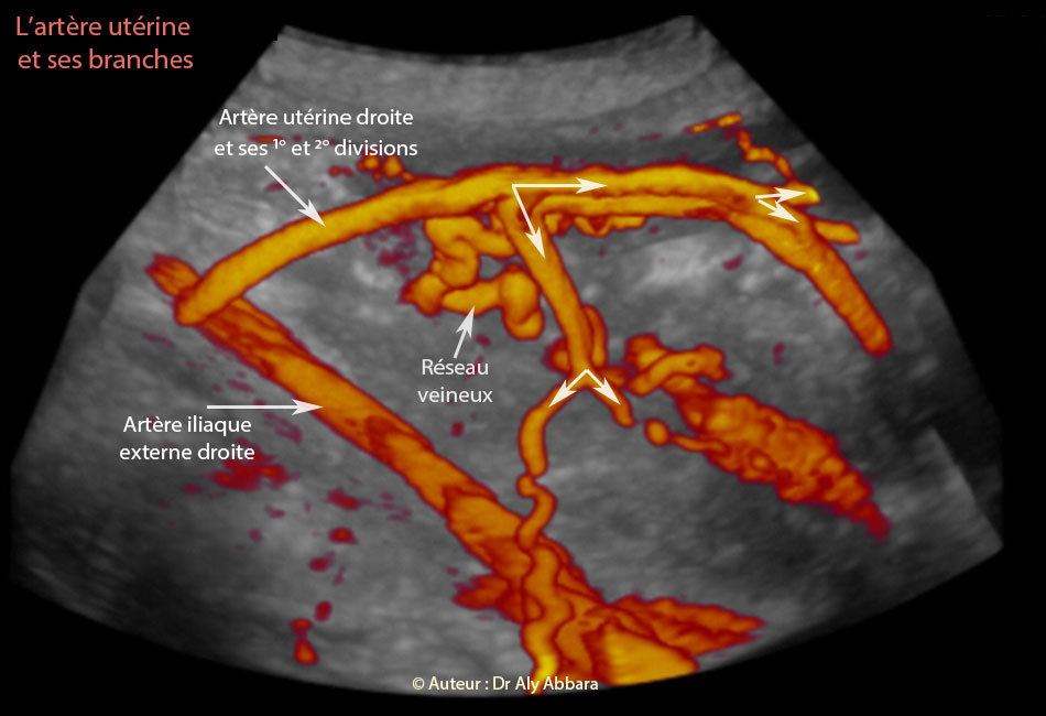 L'artère utérine droite est ses branches - image et texte