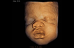 Face foetale en 3D, pivotante