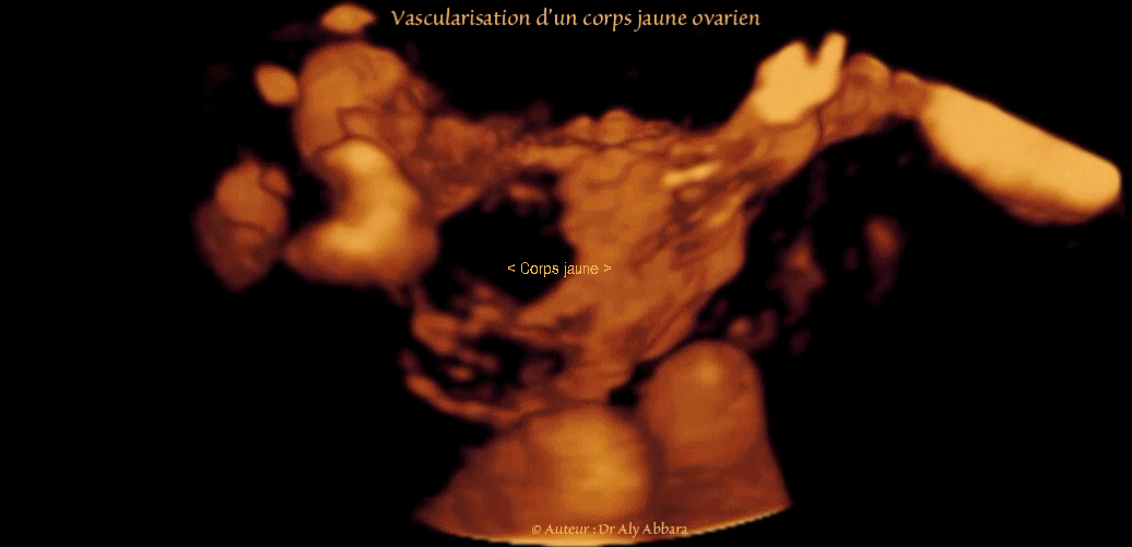 Vascularisation du corps jaune analysée en échographie 3D et Doppler-énergie - الجسم الأصفر وتوعيته الخاصة 