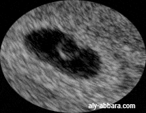 Acivité cardiaque foetale chez un embryom de 1,7 mm de longueur cranio-codale