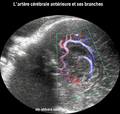 L'atère cérébrale antérieure et ses branches