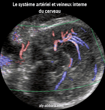 Artère cérébrale antérieure et ses branches ; la circulation veineuse interne du cerveau