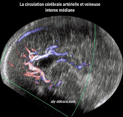 Image montrant le système de vascularisation cérébrale médiane, artérielle et veineuse