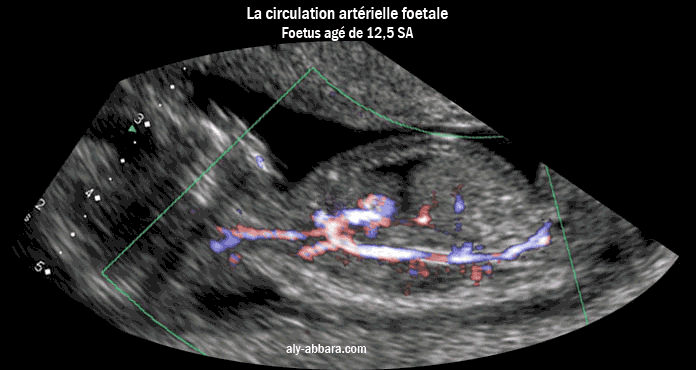 La circulation feotale artérielle à 12,5 SA