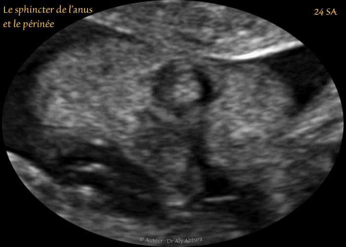 Anus et périnée - aspect échographique  - الشرج والعجان - المظهر التصويري الصدوي