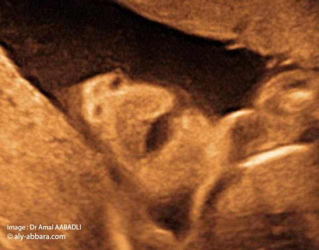 Coupe frontale de face : nez, bouche et menton_01