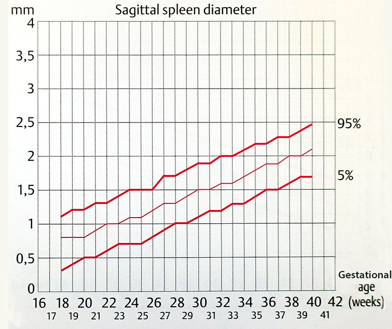 Biométrie de la rate foetale - diamètre sagittal