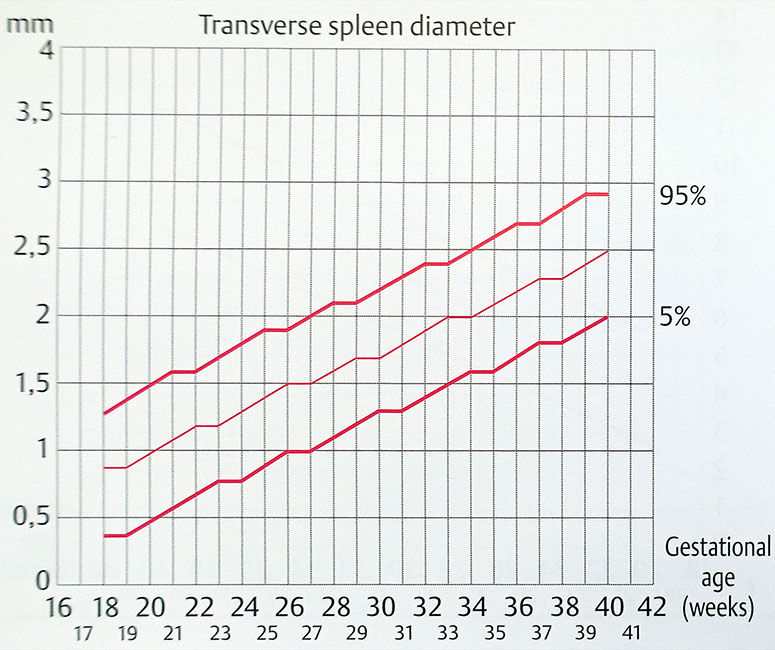 Biométrie de la rate foetale - largeur