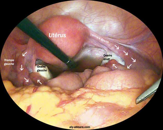 Epreuve Au Bleu De Methylene Permeabilite Tubaire
