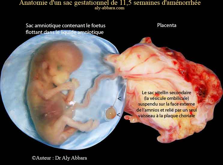 Embryon De 7 Semaines D Amenorrhee Et 2 Jours Activite Cardiaque Et Circulation Vitelline