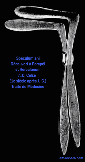 Spéculum ani, découvert à Pompéi, et décrit par Celse au 1e siècle après J.-C.