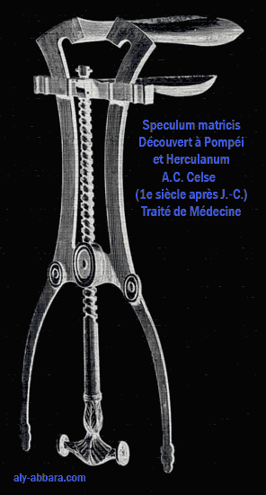 Spéculum matricis, en bronze, découvet à Pompéi et décrit par A.C. Celes, dans son traité de Médecin, qui remonte au premier siècle après J.-C.