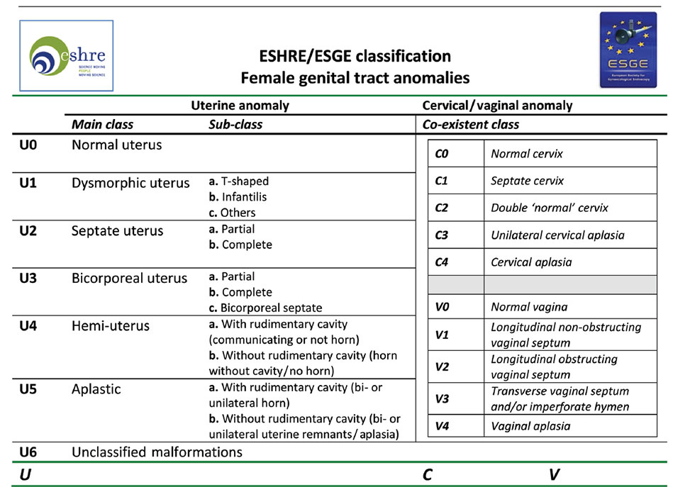 Classification des anomalies du tractus génital féminin selon ESHRE-ESGE