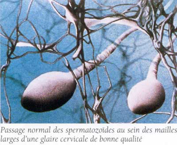 Glaire endocervicale fluide permettant le  passage des spermatozoïdes