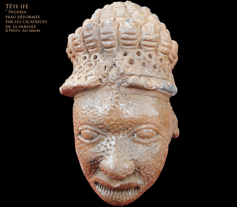 Statue de la culture d'Ifè - Tête à peau cicatricielle (variole) - Nigeria