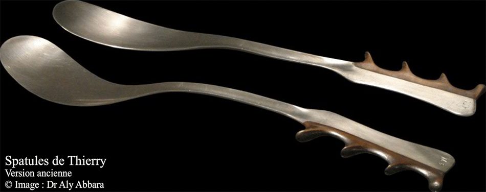 Spatules de Thierry