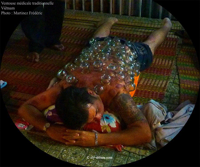 Ventouse utilitaire médicale