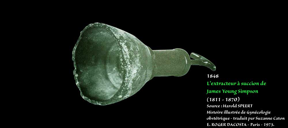 Ventouse d'extraction obstétricale modèle Simpson 1848 à usage unique