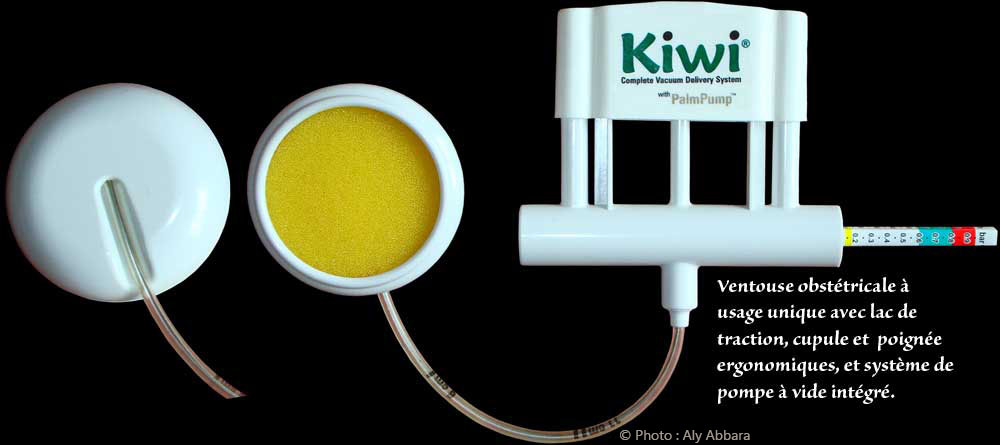 Ventouse d'extraction obstétricale modèle Kiwi à usage unique