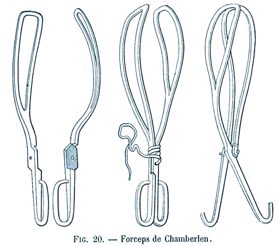 Forceps de Chamberlen