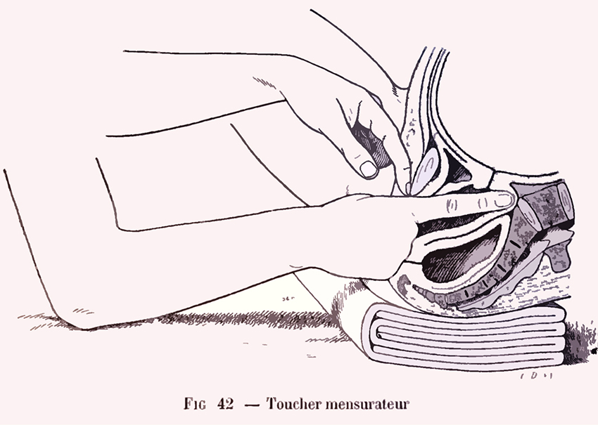 Toucher vaginal mensurateur